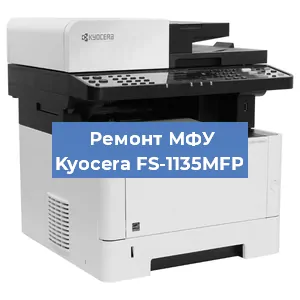 Замена лазера на МФУ Kyocera FS-1135MFP в Воронеже